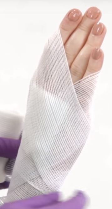 Roller bandage wrapped both diagonals across back of hand.