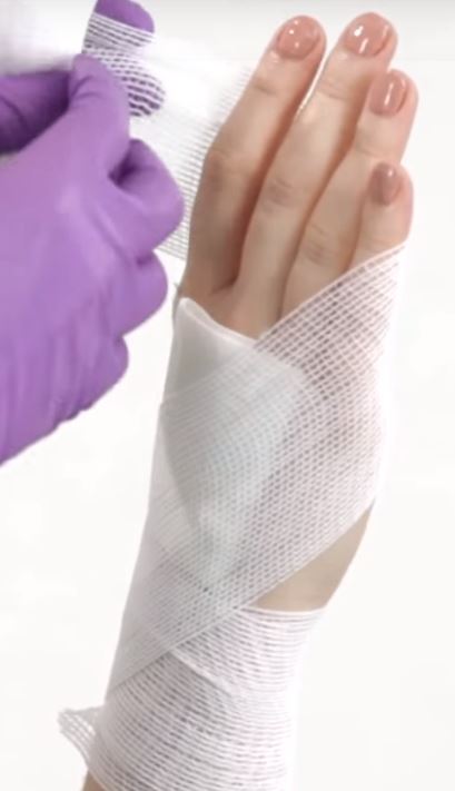 Roller bandage wrapped across person's fingers.